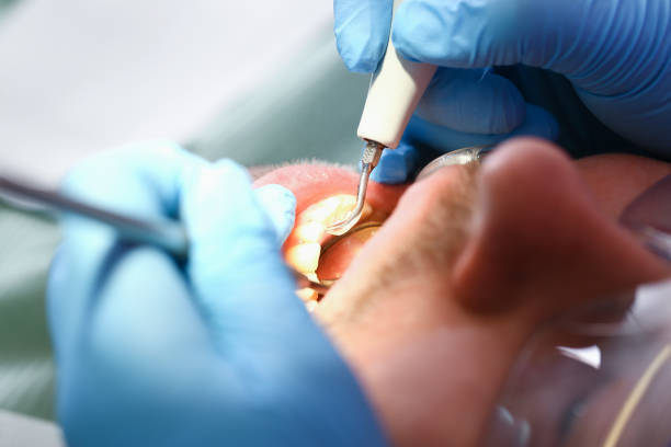 Best Mobile Emergency Dentist in Livingston, TX