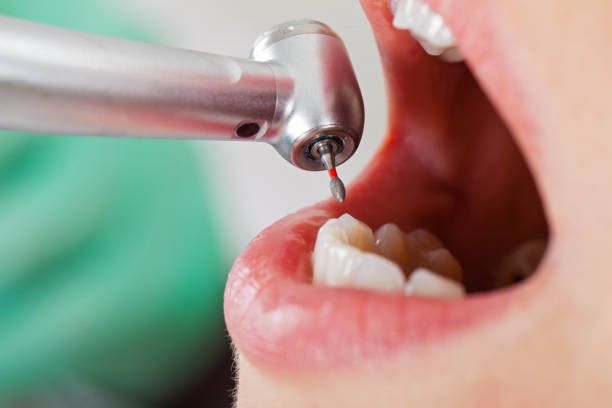Best Urgent Dental Care for Toothache in Livingston, TX